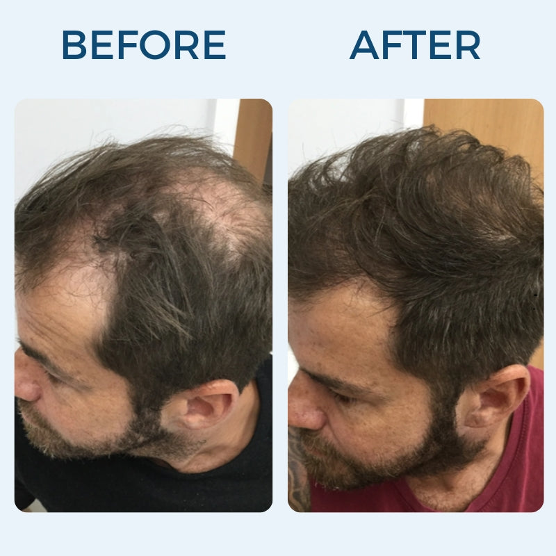 Mirus Hair Renewal Serum