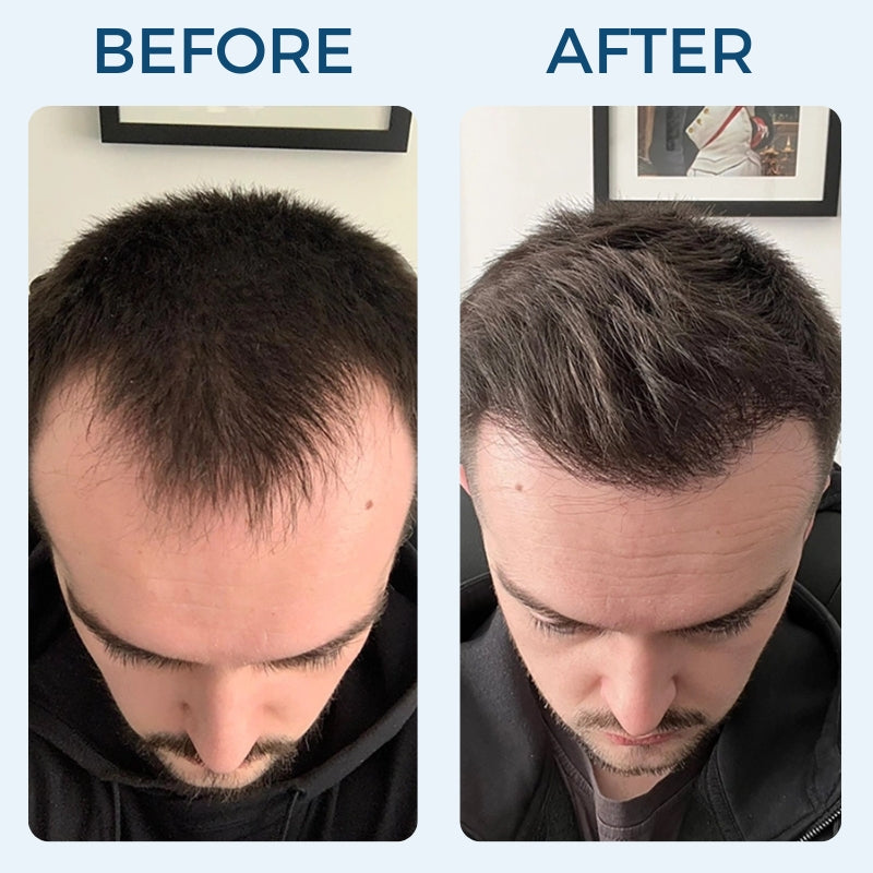 Mirus Hair Renewal Serum