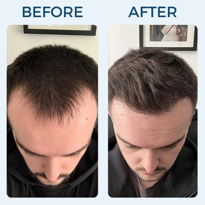 Mirus Hair Renewal Serum